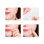 PARCHE ANTI ACNE  72 UNID KNT